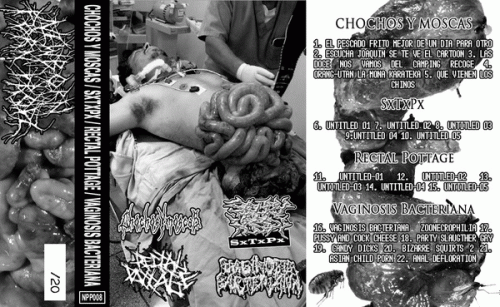 Vaginosis Bacteriana : Chochos y Moscas - SxTxPx - Rectal Pottage - Vaginosis Bacteriana